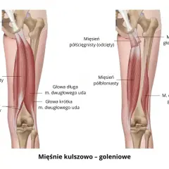 Anatomia mięśni kulszowo-goleniowych. Ilustracja pokazuje mięsień dwugłowy uda, jego głowy długą i krótką. Zapalenie mięśnia czworogłowego uda objawy mogą być podobne.
