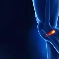 Anatomia kolana z podświetloną łąkotką przyśrodkową, kluczową dla stabilności stawu.