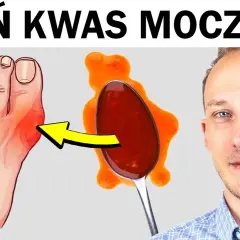 Atak dny moczanowej? Co pomoże bez recepty! Natychmiastowa ulga