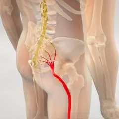 Anatomia nerwu kulszowego, kluczowego dla zrozumienia, jakie zabiegi na rwę kulszową są skuteczne.