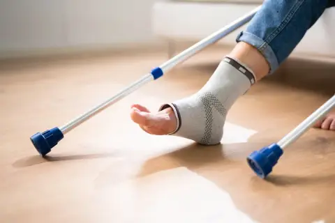 Osoba w opasce na kostce, z kulami, rozpoczyna chodzenie po artrodezie stawu skokowego.