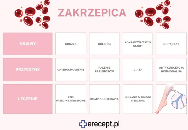 Zakrzepica: Jakie leki wybrać? Opcje, zasady i bezpieczeństwo