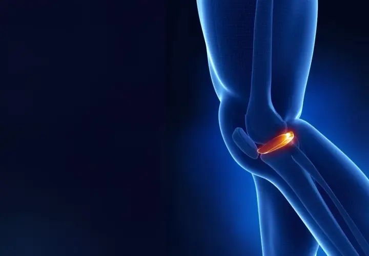 Anatomia kolana z podświetloną łąkotką przyśrodkową, kluczową dla stabilności stawu.
