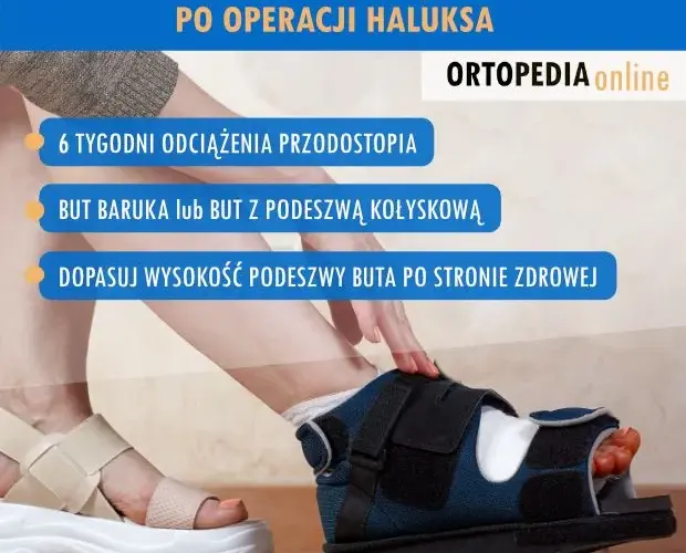 Po operacji haluksa: Jakie buty wybrać, by stopa szybko wróciła do zdrowia?
