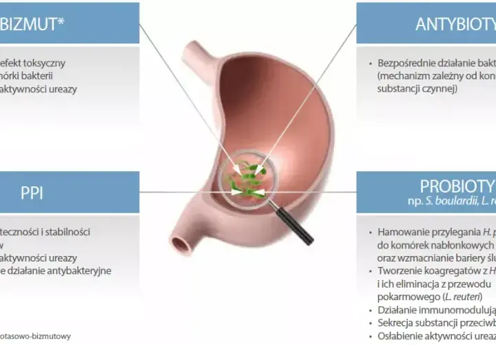 Leki na Helicobacter pylori: Skuteczna terapia i schematy leczenia