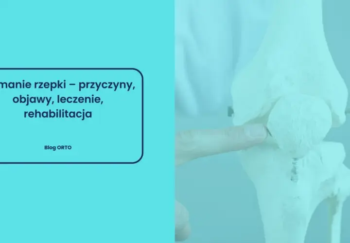 Model stawu kolanowego z zaznaczonym złamaniem rzepki. Tekst informuje o przyczynach, objawach, leczeniu i rehabilitacji.