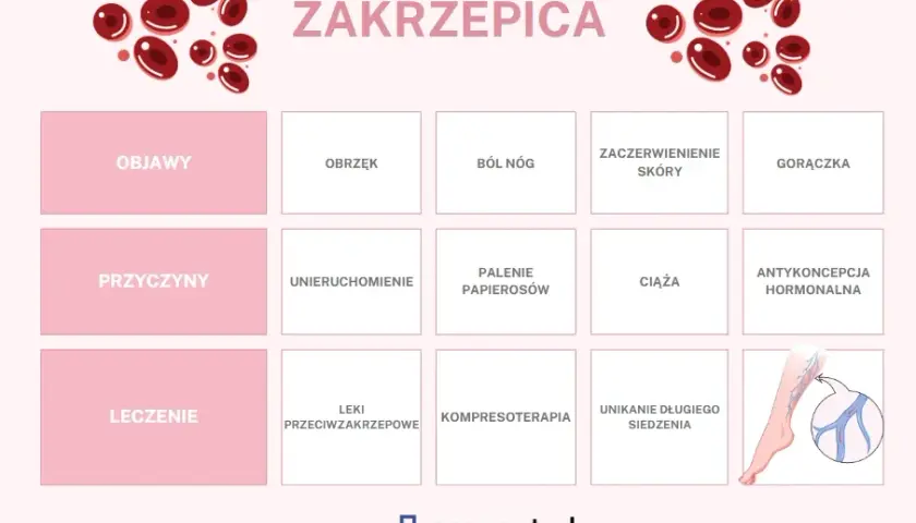 Zakrzepica: Jakie leki wybrać? Opcje, zasady i bezpieczeństwo