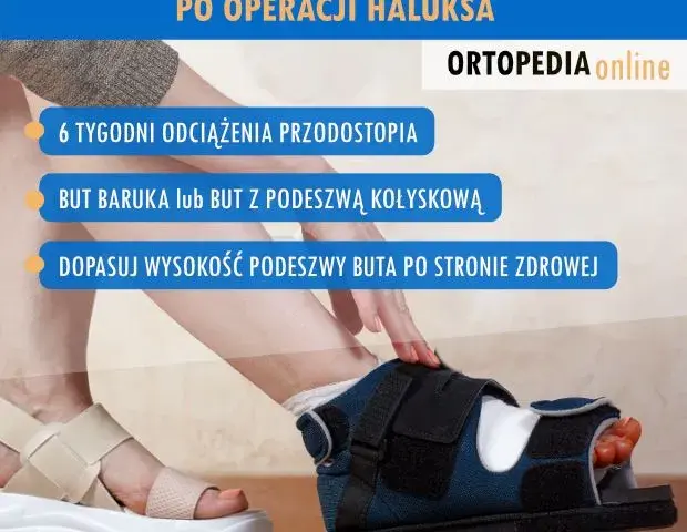 Po operacji haluksa: Jakie buty wybrać, by stopa szybko wróciła do zdrowia?