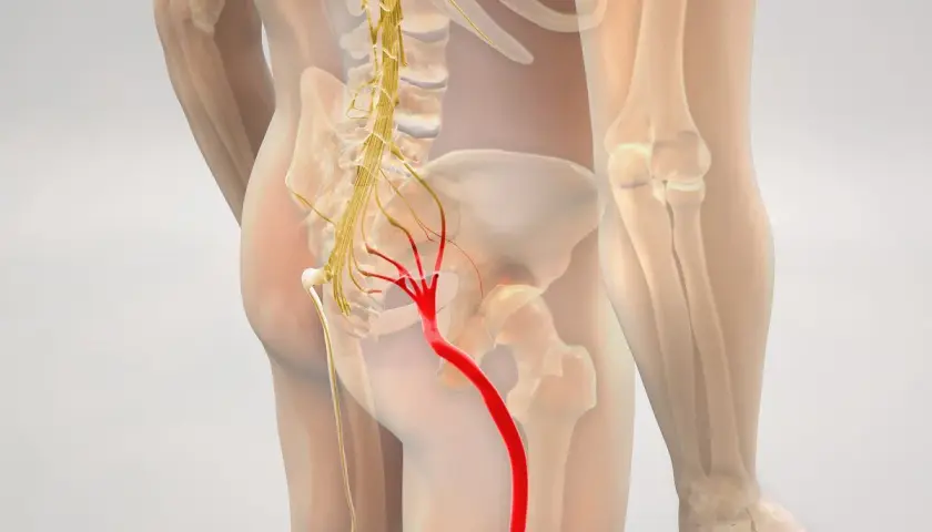 Anatomia nerwu kulszowego, kluczowego dla zrozumienia, jakie zabiegi na rwę kulszową są skuteczne.