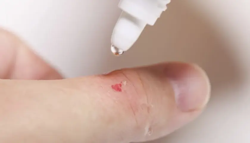 Czy woda utleniona szkodzi ranom? Zaktualizuj apteczkę!
