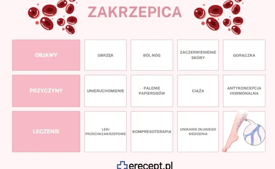 Zakrzepica: Jakie leki wybrać? Opcje, zasady i bezpieczeństwo