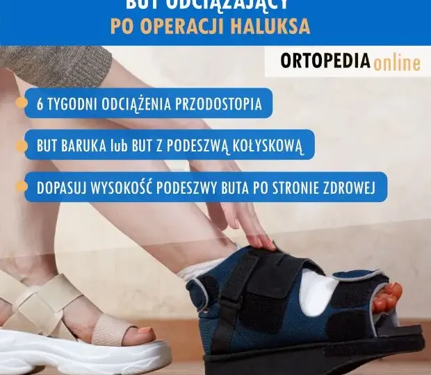 Po operacji haluksa: Jakie buty wybrać, by stopa szybko wróciła do zdrowia?