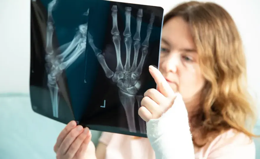 Złamanie spiralne kości - jak wygląda diagnoza i leczenie?