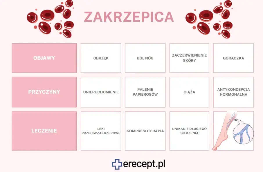 Zakrzepica: Jakie leki wybrać? Opcje, zasady i bezpieczeństwo