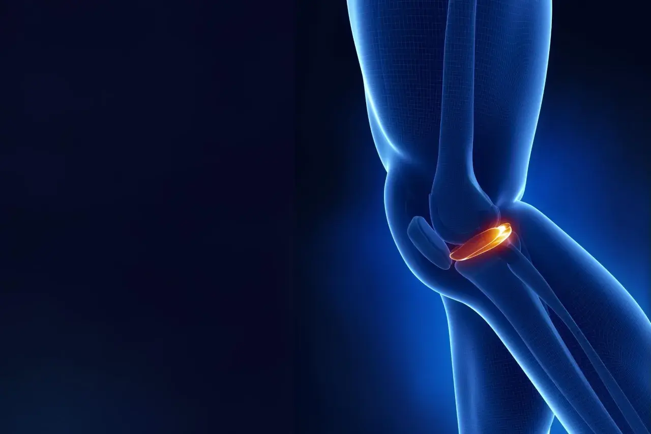 Anatomia kolana z podświetloną łąkotką przyśrodkową, kluczową dla stabilności stawu.