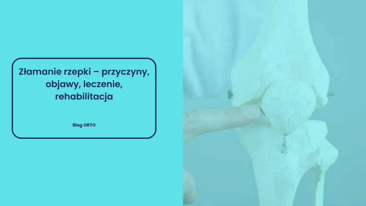 Model stawu kolanowego z zaznaczonym palcem złamanie rzepki. Informacje o przyczynach, objawach i leczeniu.