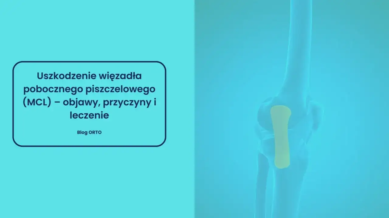 Ból więzadła pobocznego w kolanie, objawy i leczenie MCL. Anatomia stawu kolanowego z zaznaczonym więzadłem.
